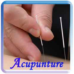 acupuncture